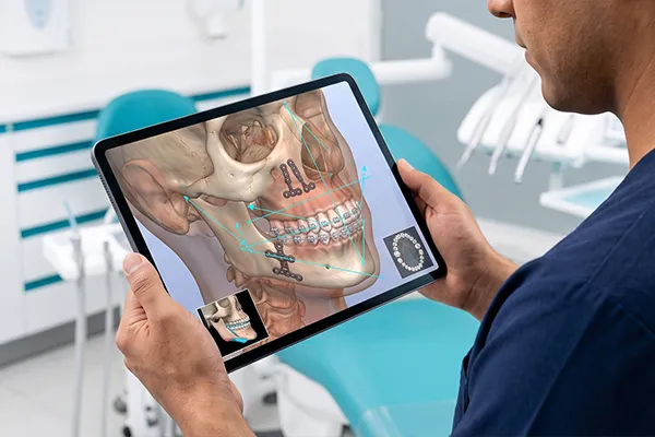 Tratamiento de ortodoncia prequirúrgica en Puebla para preparación de cirugía maxilofacial